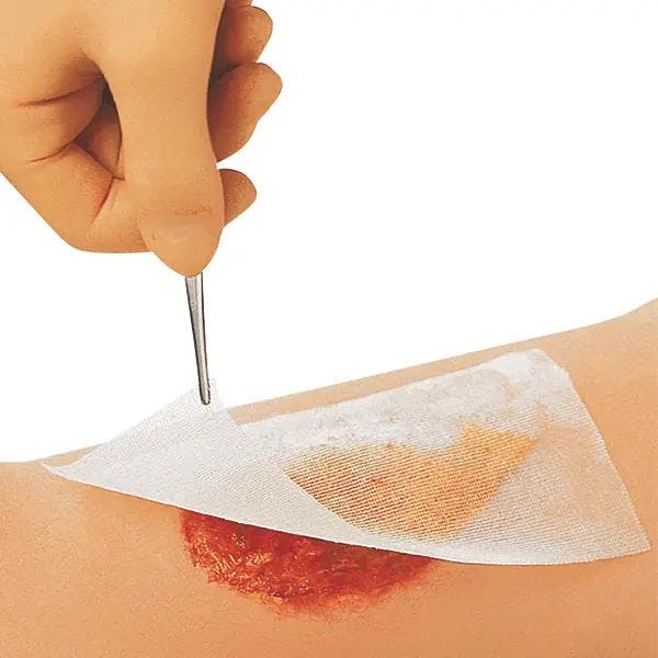 Cuticerin - Salbenbeschichtete Kunstseidengaze mit Eucerit Produktbild Print Hauptbild L