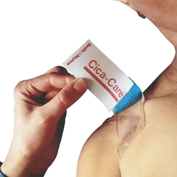 Cica-Care Silikongel-Verband Produktbild Print Hauptbild L