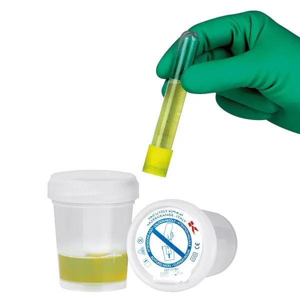 Sicherheits-Urinsammelsystem - Für die kontaminationsfreie Entnahme aus Uringefäßen Produktbild Web Groß Detailbild 2 L