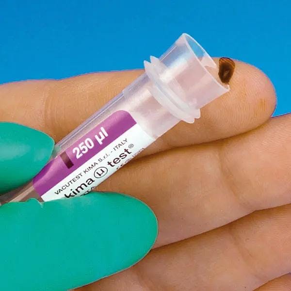 Paediatrie Blutprobengefäß EDTA-Beschichtet - Für Entnahme kleinster Kapillarblutmengen Produktbild