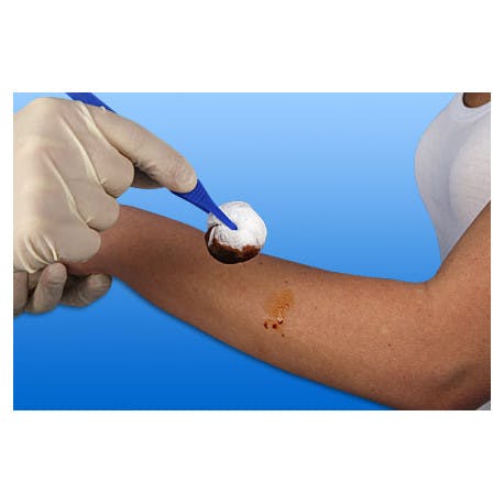 Noba-Mulltupfer, Steril-Set - Pflaumengroß Ø 3cm in weicher Tiefziehfolie Produktbild Web Groß Detailbild 4 L