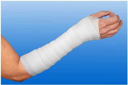 Nobapad - Polsterbinden aus synthetischer Watte, 20 Stück Produktbild Web Groß Detailbild 1 L