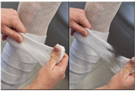 Nobapad - Polsterbinden aus synthetischer Watte, 20 Stück Produktbild Web Groß Detailbild 3 L