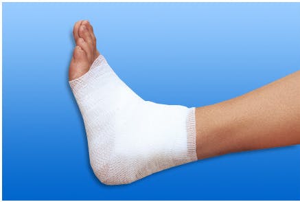 NOBATEX Hospital - Elastische Fixierbinden (gekreppt), 50 Stück Produktbild Web Groß Detailbild 2 L