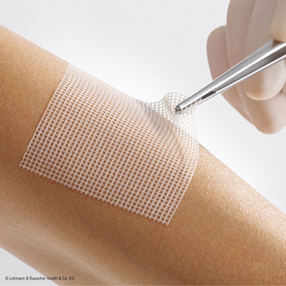 Lomatuell Pro, Lohmann & Rauscher - Gelbildende Wundauflage mit offener Netzstruktur Produktbild Web Groß Detailbild 1 L